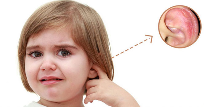 درمان اگزما گوش | اگزمای گوش